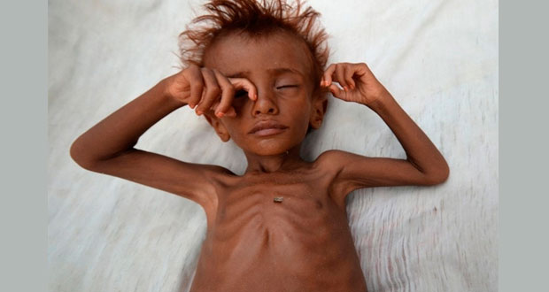Yemen, víctima de una guerra sin cesar