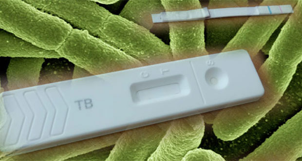 Científicos crean una tira reactiva para detectar tuberculosis