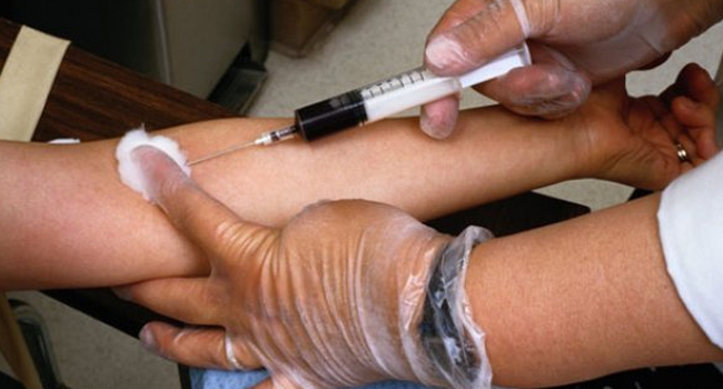 Puebla, lugar 10 en casos nuevos de Sida; se detectan 116 en primer semestre