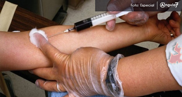 El 30% de 8 mil 463 casos de Sida en Puebla, detectados en la última década