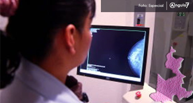 En lucha contra el cáncer, Puebla es 10º en mastografías