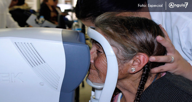 En México, cataratas causan 45% de ceguera en adultos, señalan