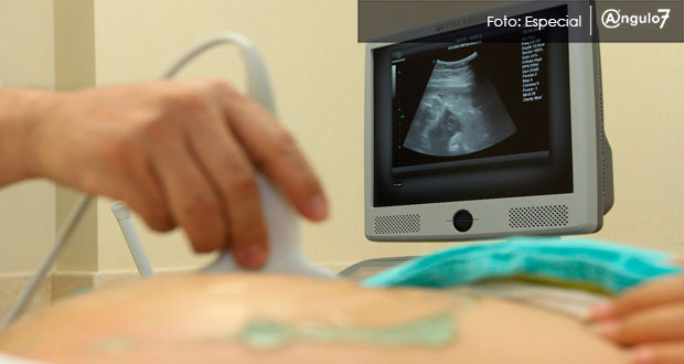 La vida empieza cuando el corazón ya late, dice arzobispo sobre el aborto