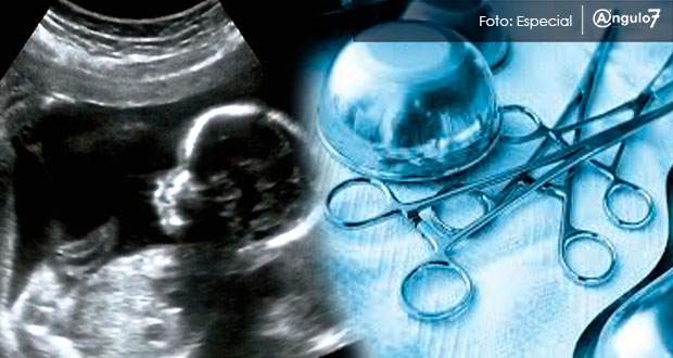PRD propondrá legalizar aborto antes de 3 meses de embarazo en Puebla
