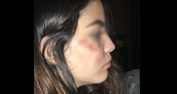 Joven denuncia que la golpearon brutalmente durante asalto en ruta 33