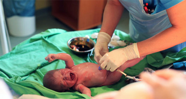 Beneficios de donar o pagar por guardar el cordón umbilical