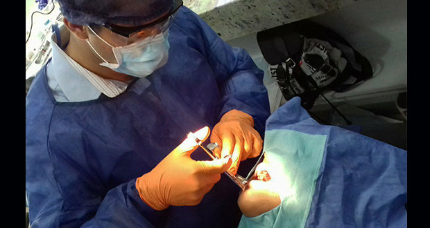 Prueban en BUAP láser que acorta recuperación tras extraer dientes