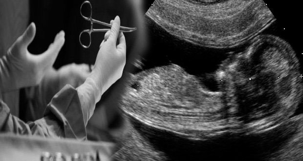 ONGs anuncian marcha contra legalización del aborto en Puebla