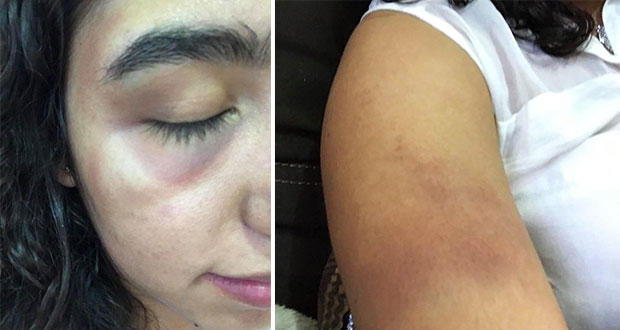 Estudiante de medicina acusa agresión sexual y física en intento de asalto