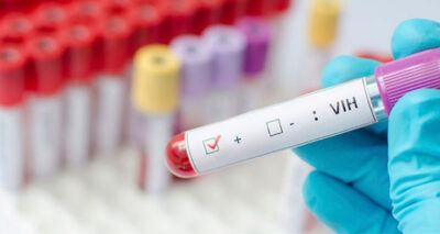 Compraremos antirretrovirales más baratos y “mejores”: Salud federal