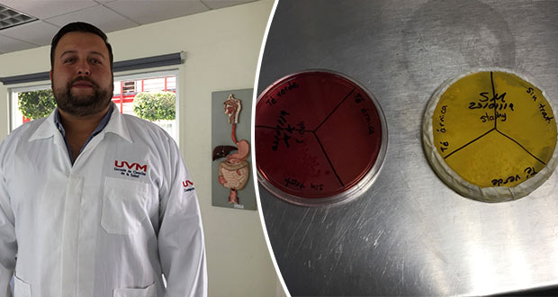 UVM crea sistema sustentable para matar bacterias a base de plata