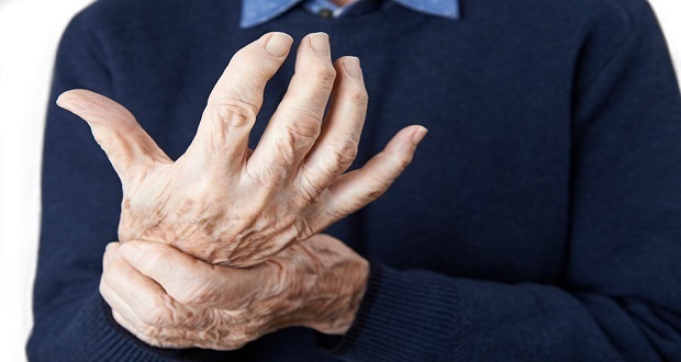 Mujeres y deportistas, con mayor riesgo de sufrir osteoartrosis