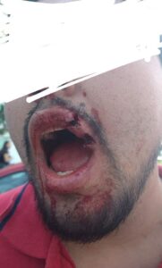 Líderes porriles de BUAP, al servicio de Esparza, golpean a alumno, acusan
