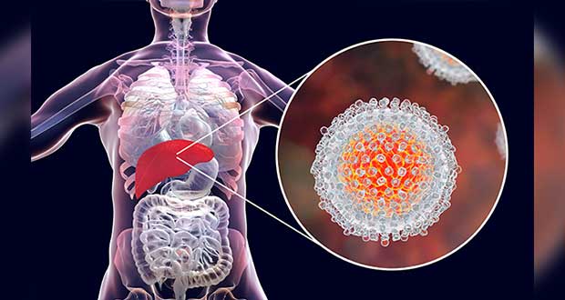 Federación va por eliminación de hepatitis C con programa nacional