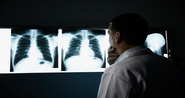 La Radiología, esencial para otras especialidades médicas: IMSS