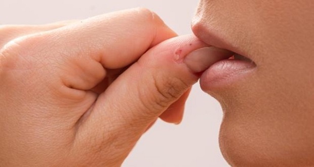¿Te muerdes las uñas cuando estás nervioso? No lo hagas