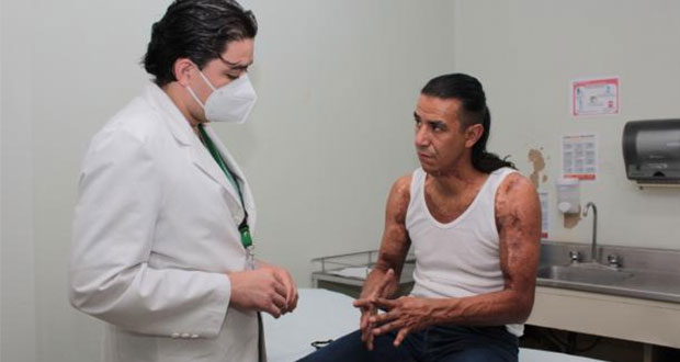 Vuelve a correr maratones tras rehabilitarse en IMSS de quemaduras