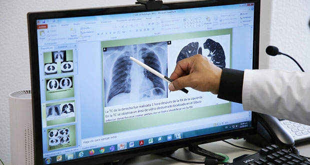 IMSS atiende daño pulmonar y dificultad respiratoria por Covid