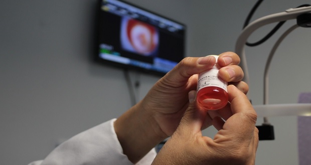 Durante este año, IMSS de La Raza trasplanta 100 córneas