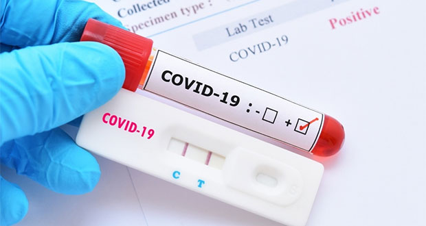Pruebas sanguíneas no sirven para detectar presencia de Covid: Salud