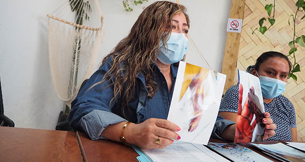 Acusan negligencia en clínica de Cholula; bebé pierde brazo y piden reparar daño