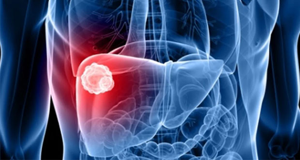 28 de julio, Día Mundial contra la Hepatitis ¿Por qué se conmemora?  