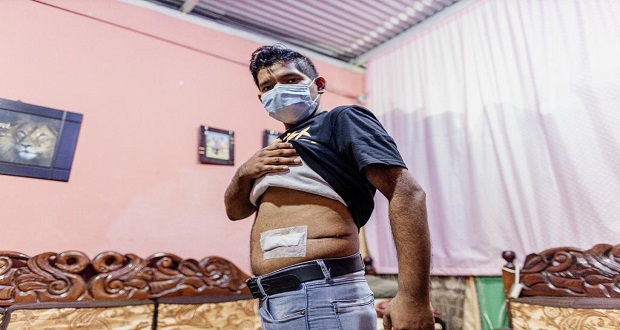 En Chiapas, médicos de IMSS extirpan tumor del tamaño de un melón