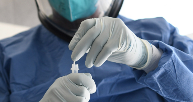 En segunda semana de julio, Puebla registra 66 contagios de COVID-19: Salud
