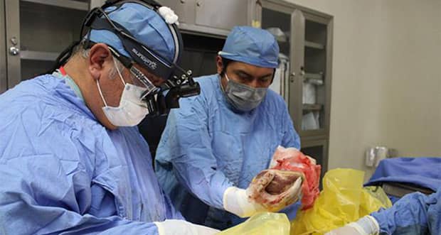 IMSS celebra 35 años del primer trasplante de corazón en México