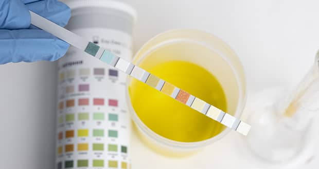 Aplicarán pruebas toxicológicas a choferes de transporte público y taxis