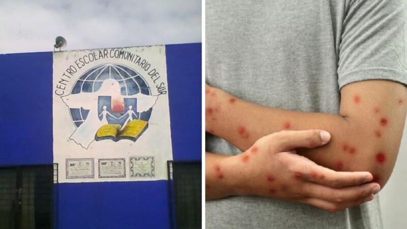 Activan protocolo sanitario por caso de sarampión en Centro Escolar del Sur de Puebla